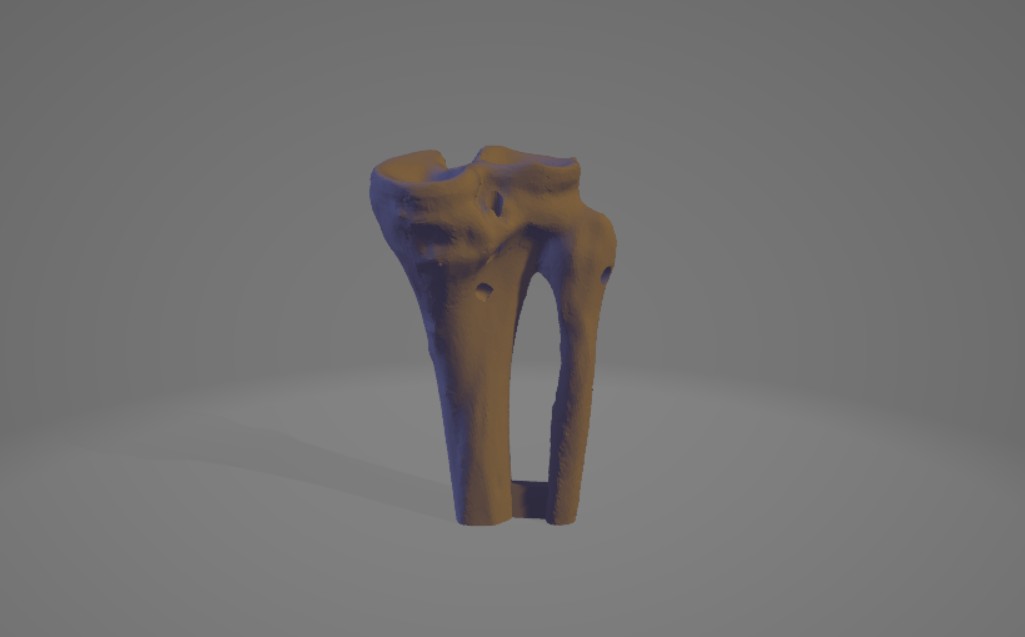 Articulación de Rodilla Funcional